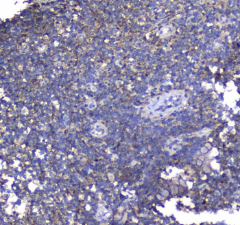 Synaptotagmin 1/SYT1 Rabbit Polyclonal Antibody