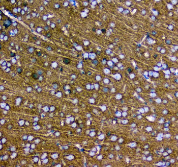 Synaptotagmin 1/SYT1 Rabbit Polyclonal Antibody