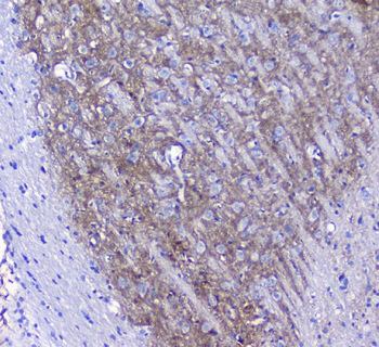 Synaptotagmin 1/SYT1 Rabbit Polyclonal Antibody