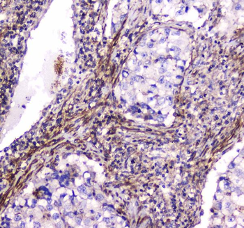 Dynamin 1/DNM1 Rabbit Polyclonal Antibody