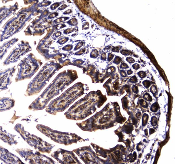 Dynamin 1/DNM1 Rabbit Polyclonal Antibody