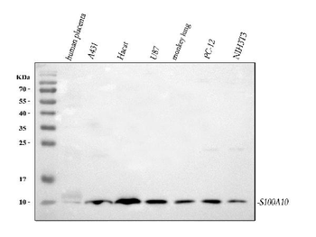 S100A10 Rabbit Polyclonal Antibody