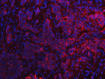 S100A10 Rabbit Polyclonal Antibody