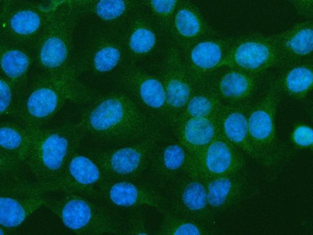 S100A10 Rabbit Polyclonal Antibody
