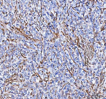 S100A10 Rabbit Polyclonal Antibody