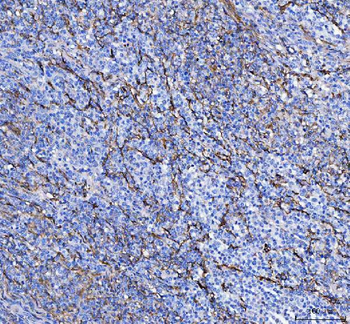 S100A10 Rabbit Polyclonal Antibody