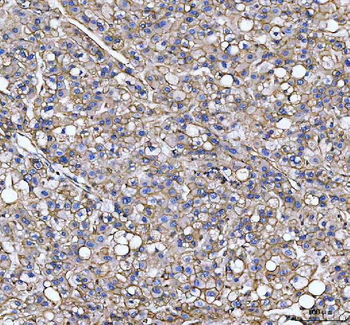 S100A10 Rabbit Polyclonal Antibody