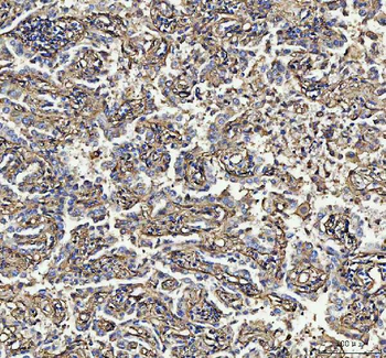 S100A10 Rabbit Polyclonal Antibody