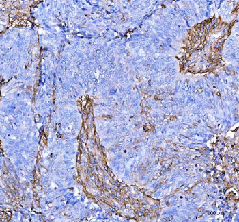 S100A10 Rabbit Polyclonal Antibody