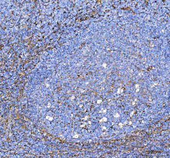 S100A10 Rabbit Polyclonal Antibody
