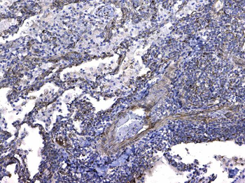 GSTM3 Rabbit Polyclonal Antibody