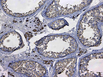 GSTM3 Rabbit Polyclonal Antibody