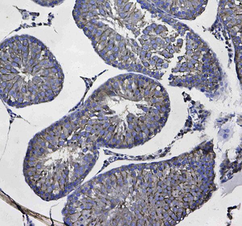 GSTM3 Rabbit Polyclonal Antibody