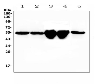 Vitamin D Binding protein/Gc Rabbit Polyclonal Antibody