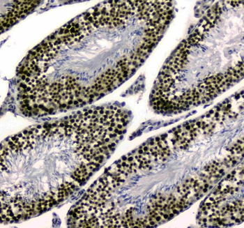 SAE2/UBA2 Rabbit Polyclonal Antibody