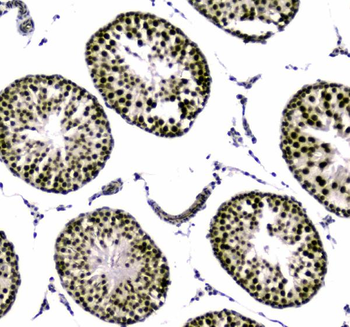 SAE2/UBA2 Rabbit Polyclonal Antibody