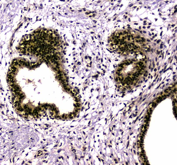 SAE2/UBA2 Rabbit Polyclonal Antibody
