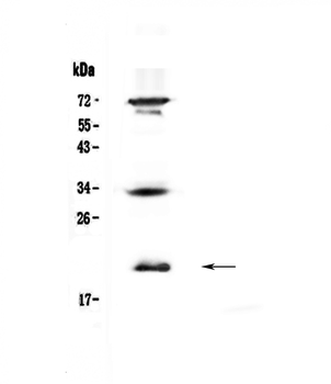 IL17B Rabbit Polyclonal Antibody