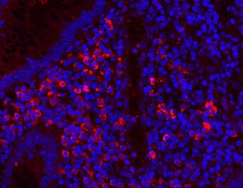 Myeloperoxidase/MPO Rabbit Polyclonal Antibody
