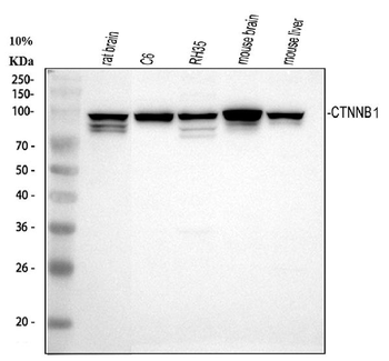 beta Catenin/CTNNB1 Rabbit Polyclonal Antibody