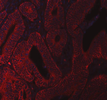 beta Catenin/CTNNB1 Rabbit Polyclonal Antibody