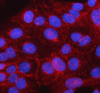 beta Catenin/CTNNB1 Rabbit Polyclonal Antibody