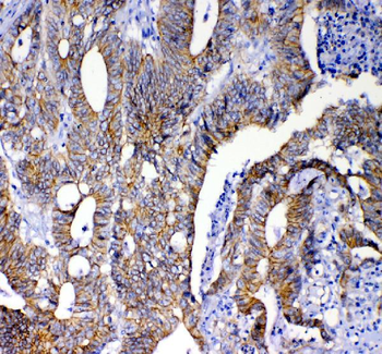 beta Catenin/CTNNB1 Rabbit Polyclonal Antibody