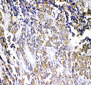 beta Catenin/CTNNB1 Rabbit Polyclonal Antibody