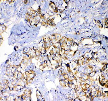 beta Catenin/CTNNB1 Rabbit Polyclonal Antibody