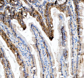 beta Catenin/CTNNB1 Rabbit Polyclonal Antibody