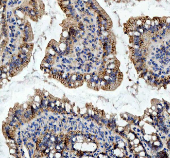 beta Catenin/CTNNB1 Rabbit Polyclonal Antibody