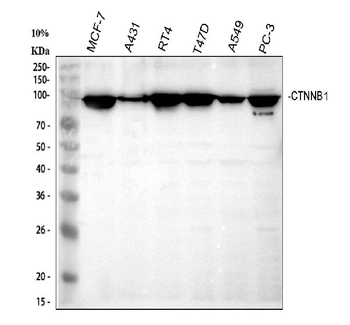 beta Catenin/CTNNB1 Rabbit Polyclonal Antibody