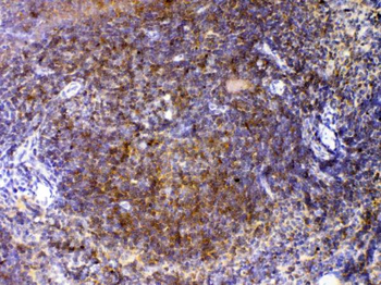 CTLA4 Rabbit Polyclonal Antibody