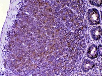 CTLA4 Rabbit Polyclonal Antibody