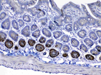 IGF1 Receptor/Igf1r Rabbit Polyclonal Antibody