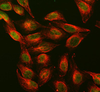 Dnmt1 Rabbit Polyclonal Antibody
