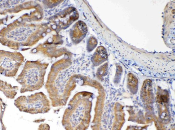 MUC1 Rabbit Polyclonal Antibody