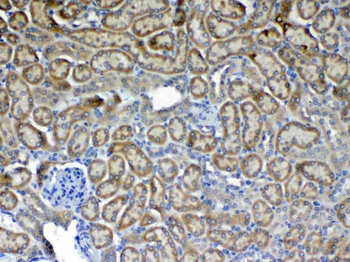 Flt3/CD135 Rabbit Polyclonal Antibody