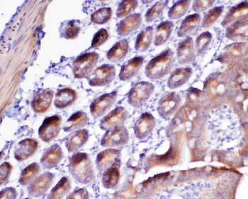 Flt3/CD135 Rabbit Polyclonal Antibody