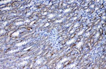 Flt3/CD135 Rabbit Polyclonal Antibody
