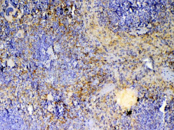 ICOS Rabbit Polyclonal Antibody