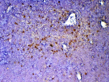 ICOS Rabbit Polyclonal Antibody