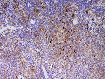 ICOS Rabbit Polyclonal Antibody