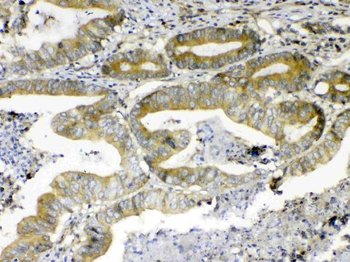 ErbB 4/ERBB4 Rabbit Polyclonal Antibody