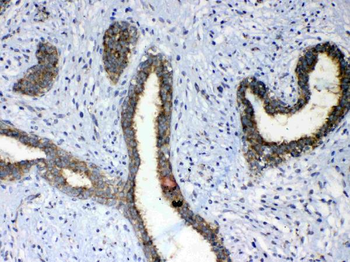 ErbB 4/ERBB4 Rabbit Polyclonal Antibody