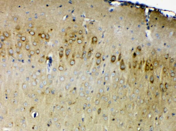 ErbB 4/ERBB4 Rabbit Polyclonal Antibody