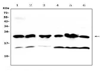 GST3/GST pi/Gstp1 Rabbit Polyclonal Antibody