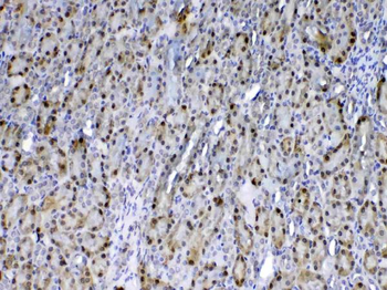 GST3/GST pi/Gstp1 Rabbit Polyclonal Antibody