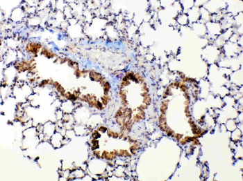 MMP13 Rabbit Polyclonal Antibody