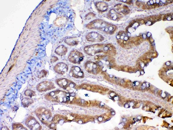 MMP13 Rabbit Polyclonal Antibody